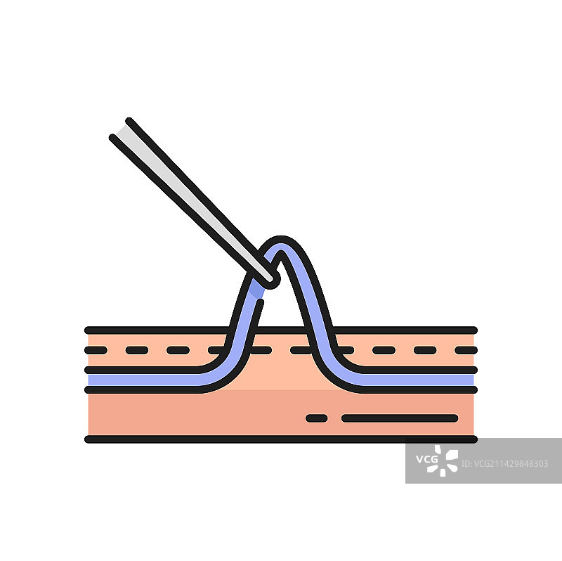 静脉曲张和蜘蛛静脉硬化疗法手术图片素材