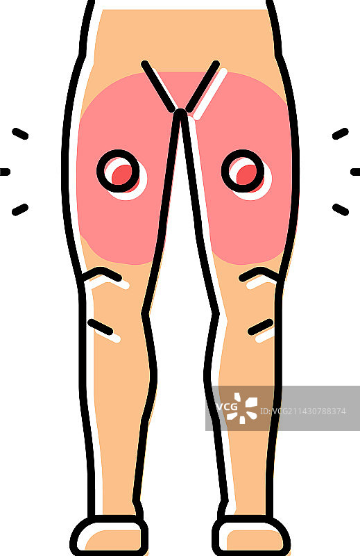 大腿疼痛身体不适彩色图标图片素材