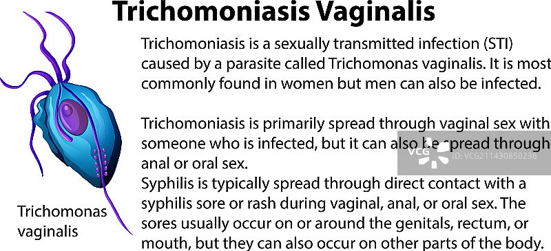 阴道毛滴虫病解释图片素材