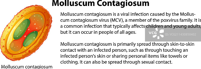 传染性软疣与解释图片素材
