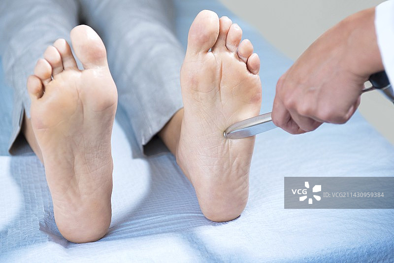 医生检查患者足底反射图片素材