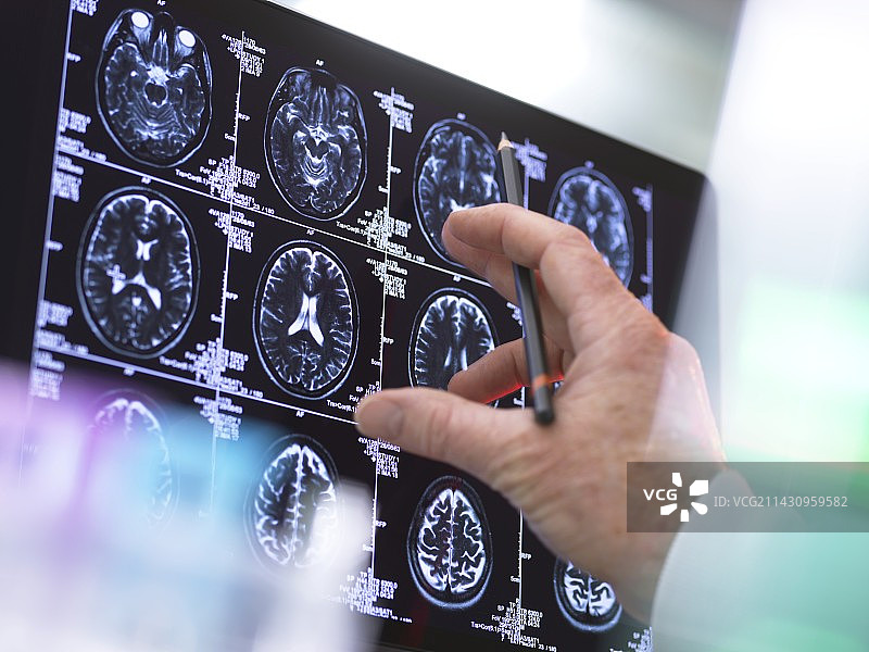 神经内科诊断图片素材
