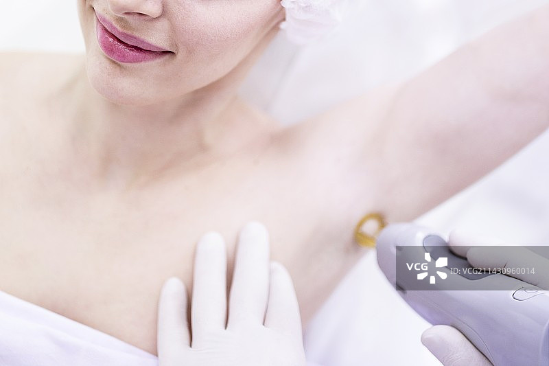 激光脱毛治疗图片素材