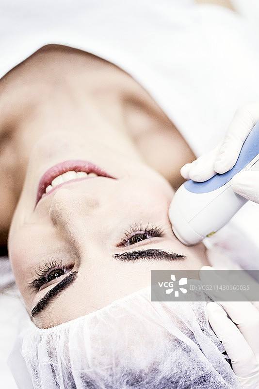 激光剥离治疗图片素材