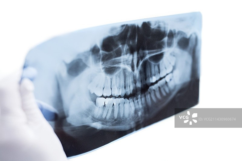 牙医拿着牙齿X光片图片素材