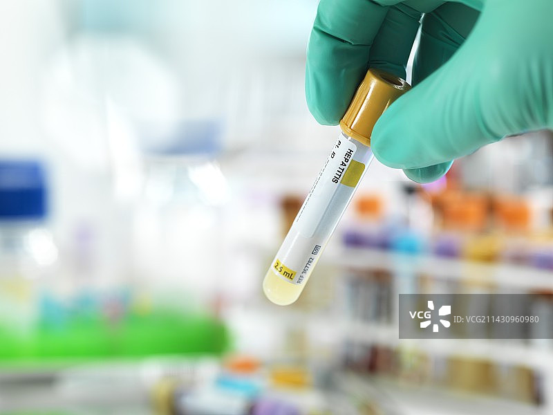 肝炎检测图片素材