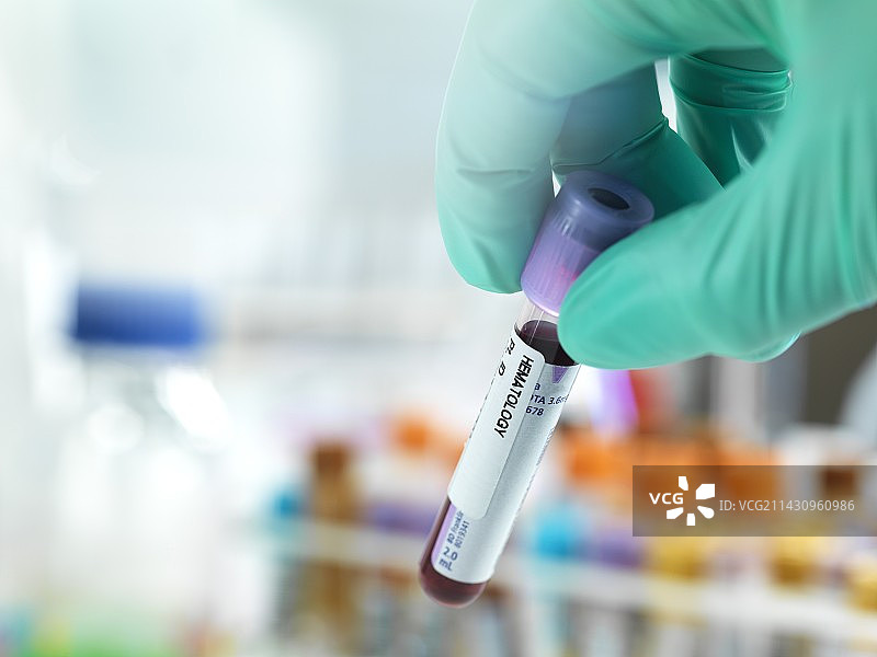 血液测试图片素材