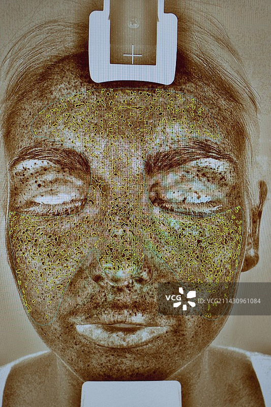 皮肤诊所中的年轻女子面部图片图片素材