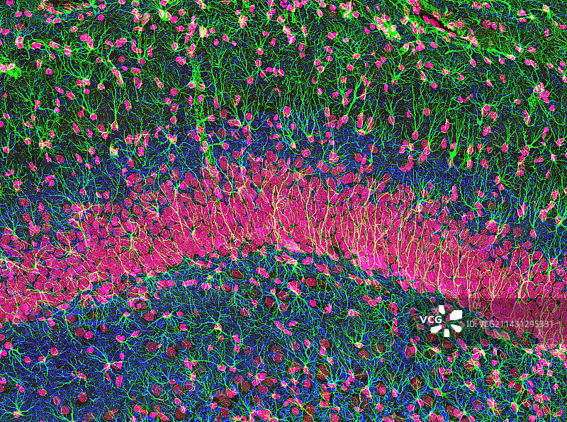 海马脑组织图片素材