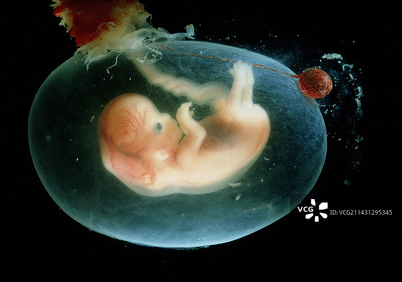 7-8周大的人类胎儿图片素材