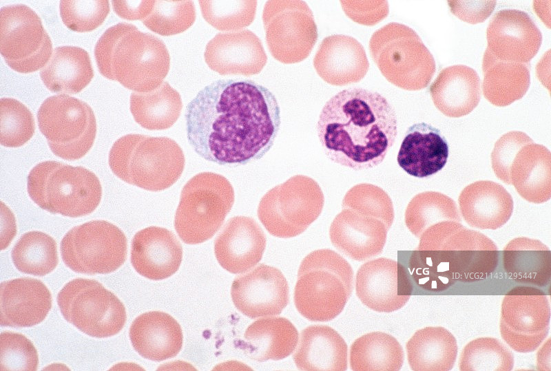 血涂片，光学显微照片图片素材