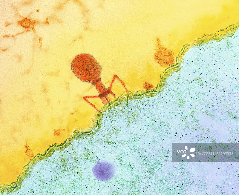 T4噬菌体感染大肠杆菌的彩色透射电镜图片素材