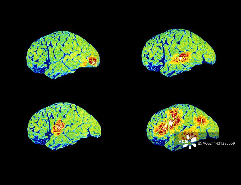 看、听、想、说图片素材