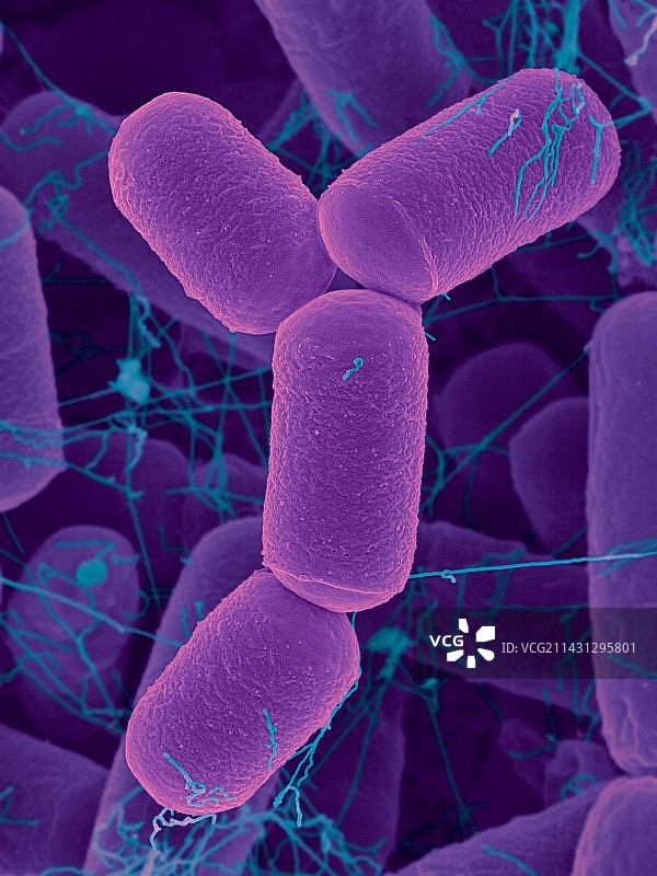 肠道古菌史氏甲烷短杆菌扫描电镜图片素材