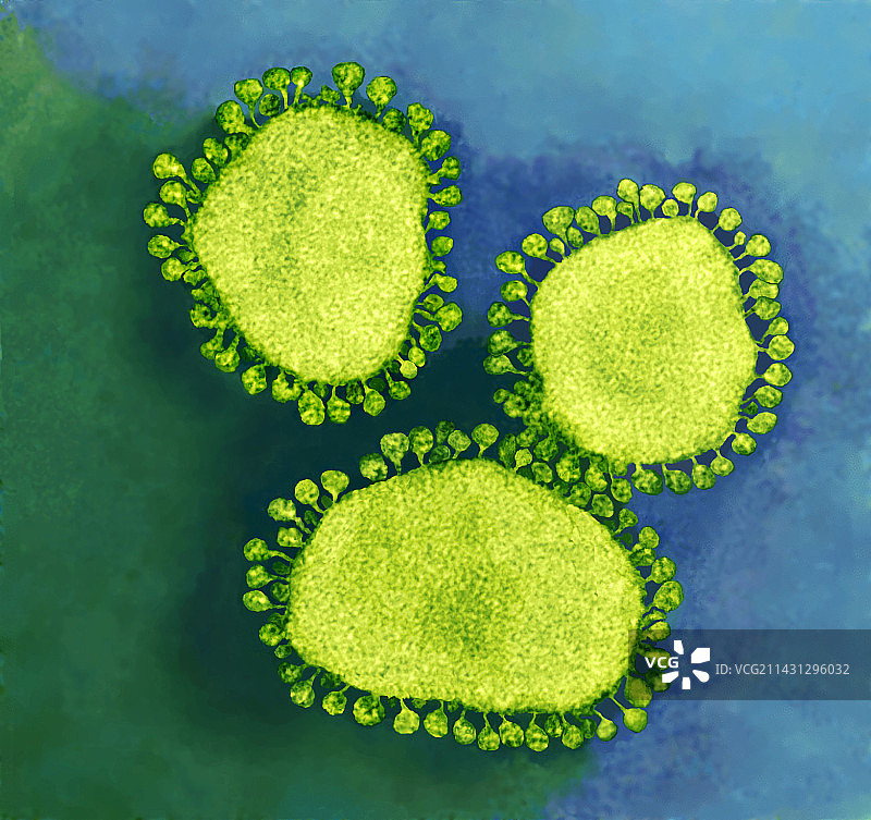 冠状病毒颗粒，TEM图片素材