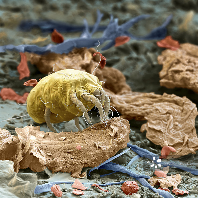 尘螨，扫描电子显微镜图片素材