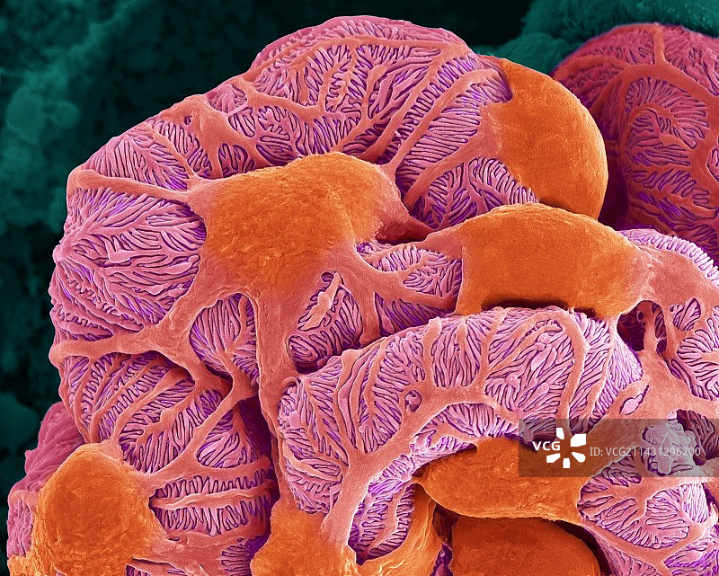 肾小球扫描电镜图图片素材