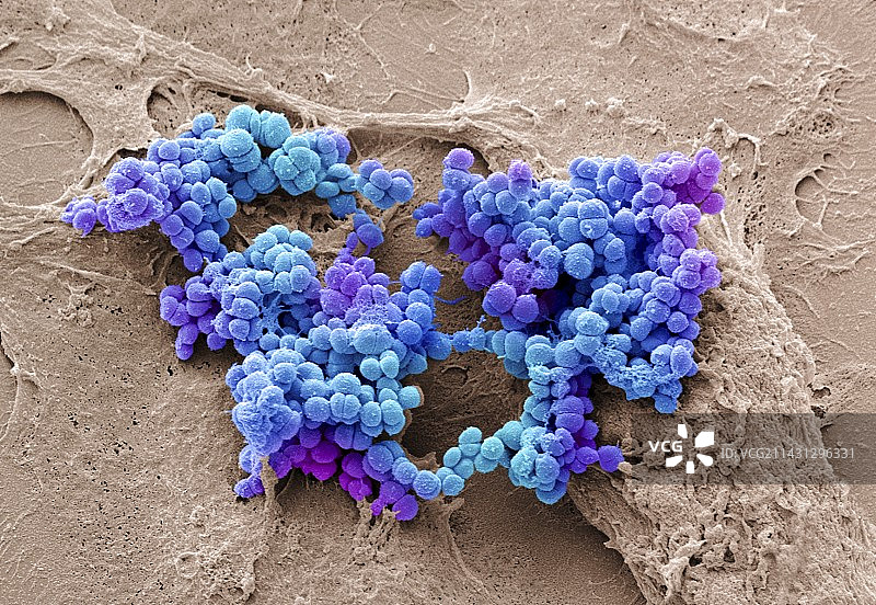 金黄色葡萄球菌，扫描电子显微镜图片素材