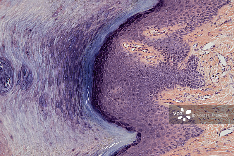 皮肤，光学显微照片图片素材