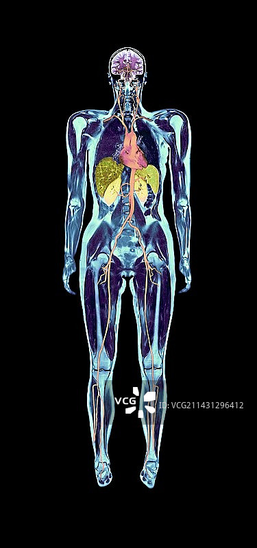 全身扫描，核磁共振扫描图片素材