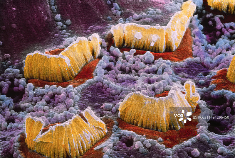 科尔蒂氏器毛细胞的扫描电镜图图片素材