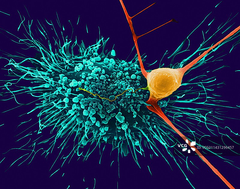 皮质神经元星形胶质细胞扫描电镜图图片素材