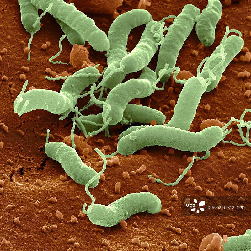 幽门螺杆菌（扫描电镜）图片素材