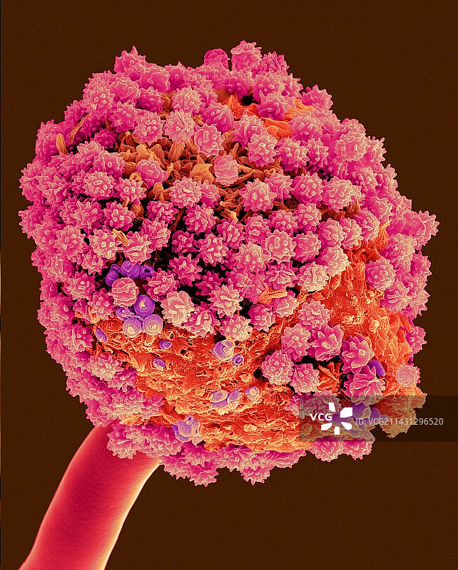 黑曲霉菌的扫描电子显微镜图像图片素材