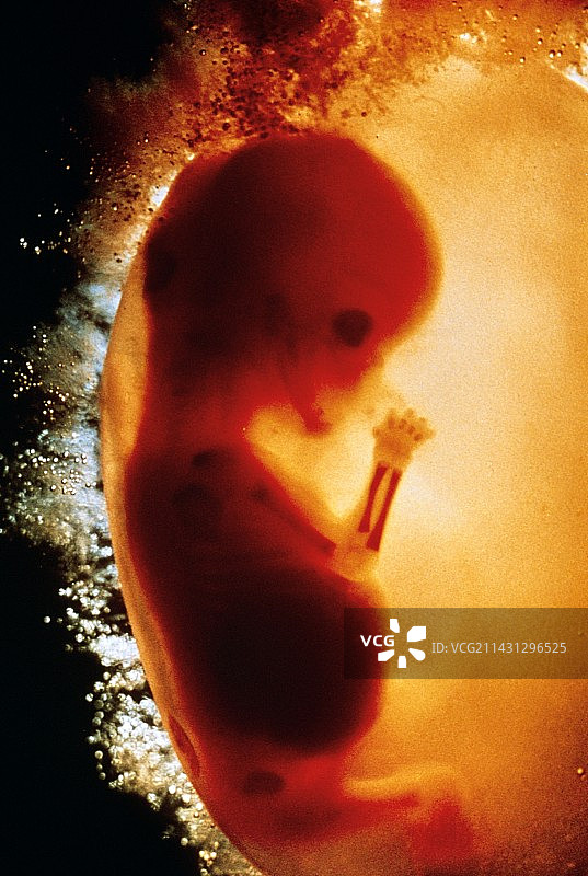 10周大的胎儿图片素材