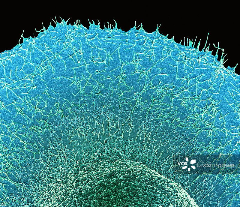结直肠癌细胞，扫描电子显微镜图片素材