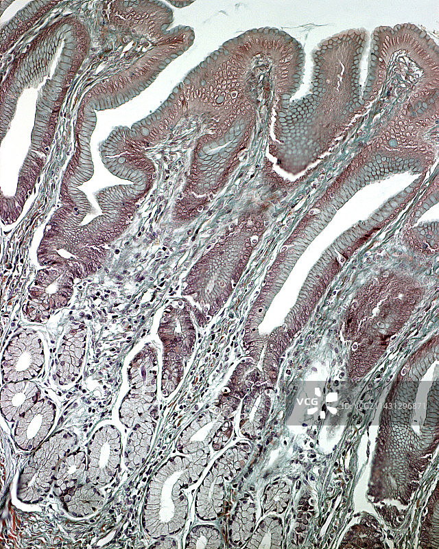 胃部切片显微照片图片素材