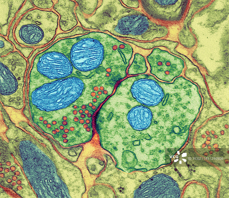 突触神经连接（透射电镜）图片素材
