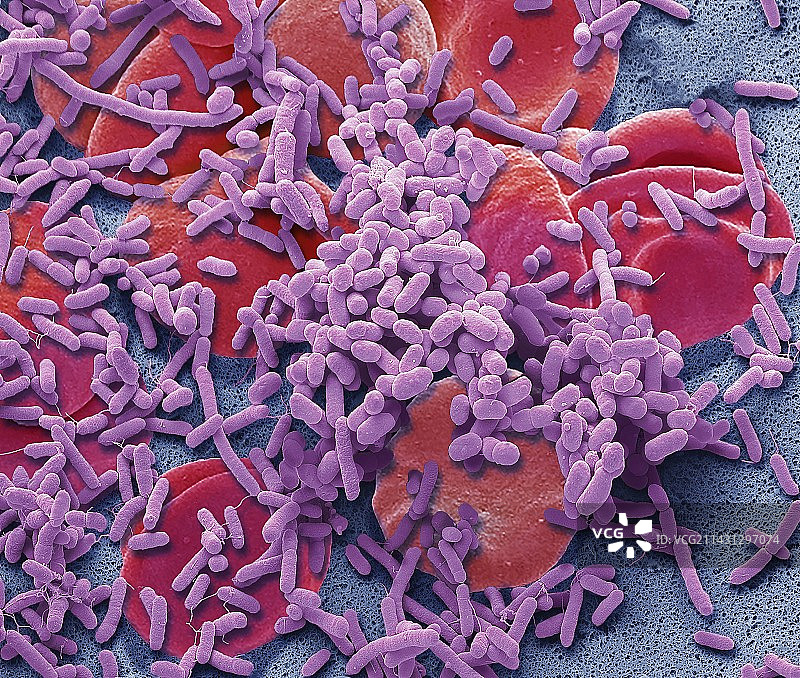 败血症扫描电镜图图片素材