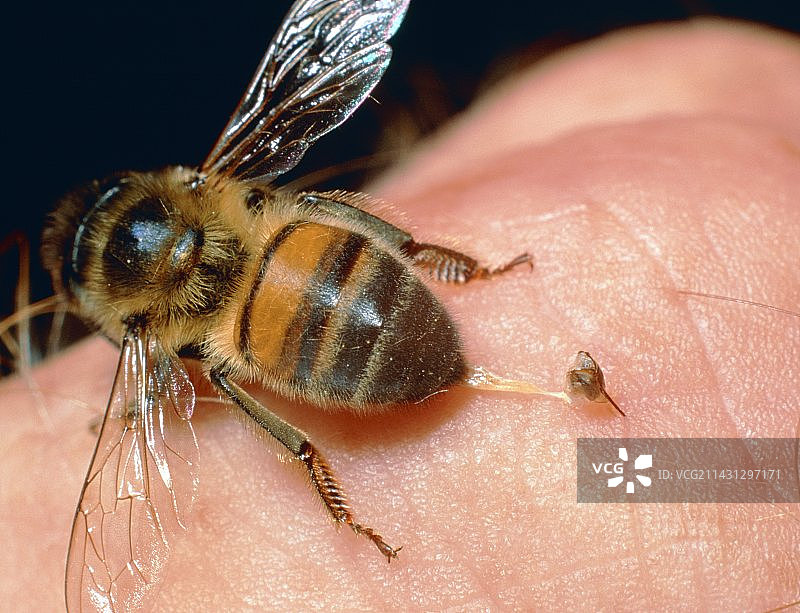 蜜蜂（Apis mellifera）蛰人手指图片素材