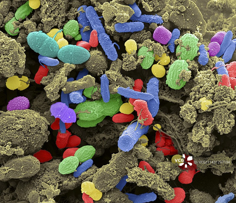 粪便细菌扫描电镜图图片素材