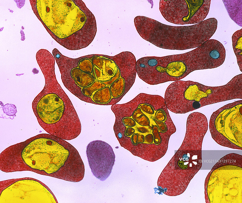 感染疟疾的红细胞的透射电镜图像图片素材