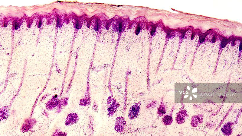 皮肤汗腺，光学显微照片图片素材