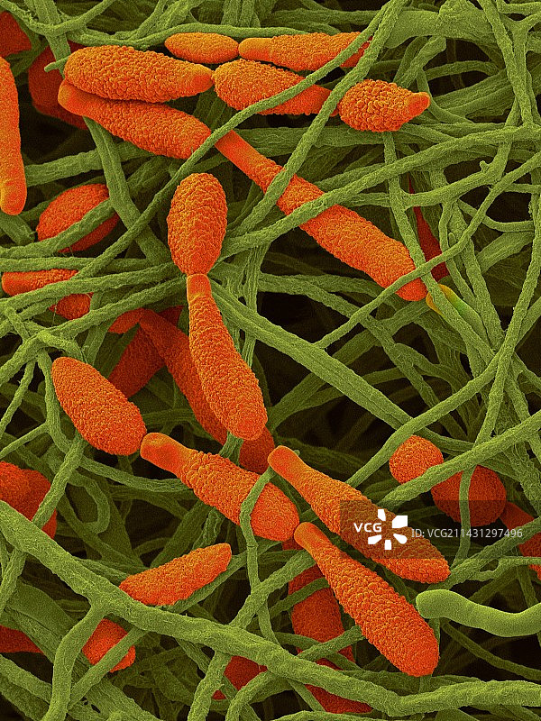 致敏真菌（链格孢霉）扫描电镜图图片素材