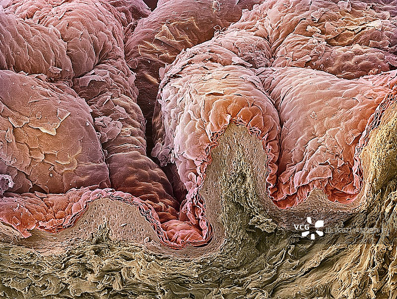 皮肤,扫描电镜图片素材