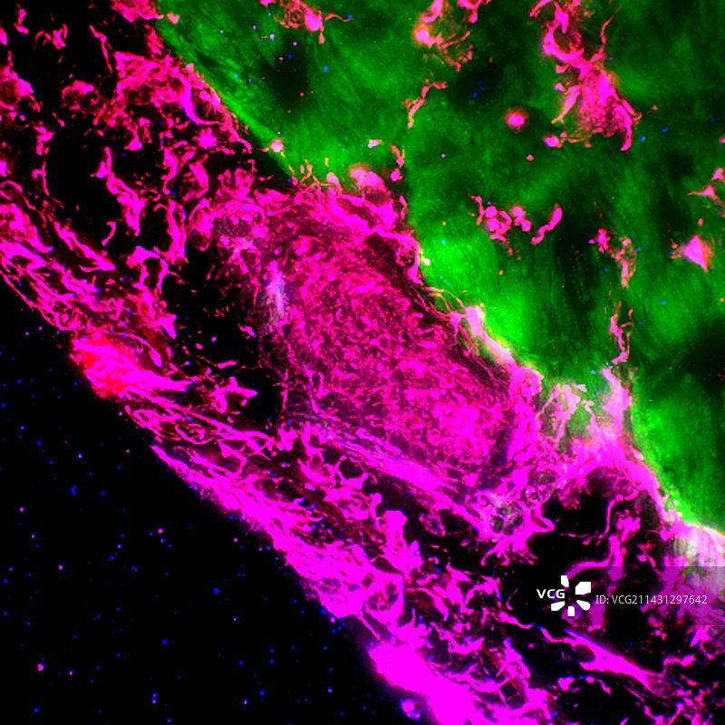 心力衰竭荧光显微照片图片素材