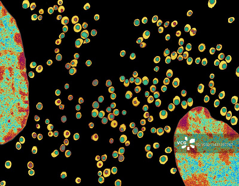 胰岛，透射电镜图片素材