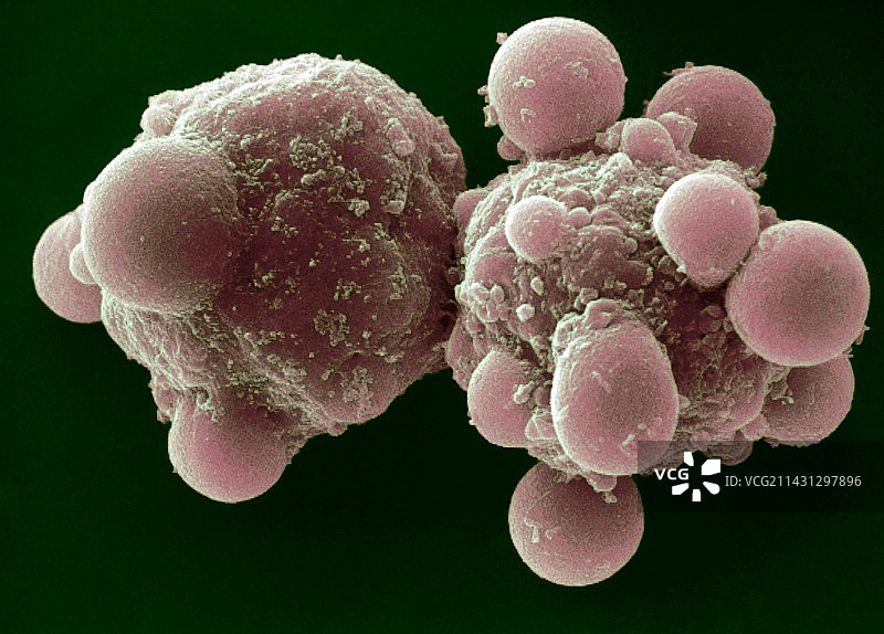 肝细胞凋亡，扫描电子显微镜图片素材