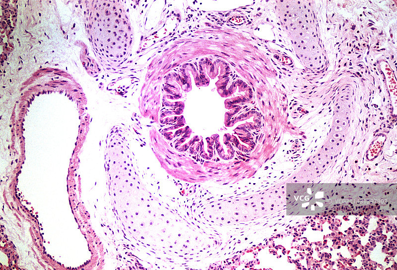 肺部细支气管横截面的光学显微镜图像图片素材