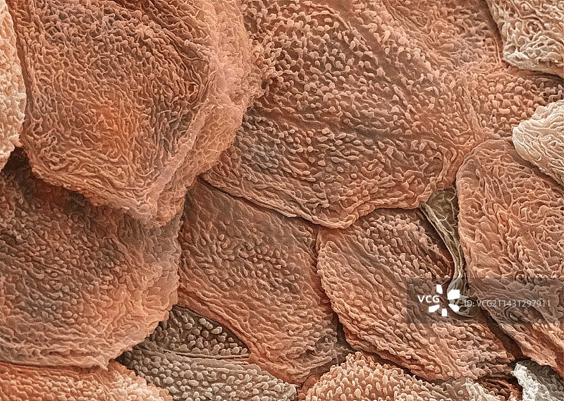 人类皮肤扫描电镜图图片素材