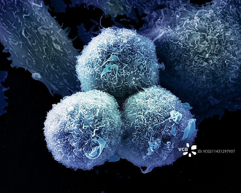 肺癌细胞扫描电镜图图片素材