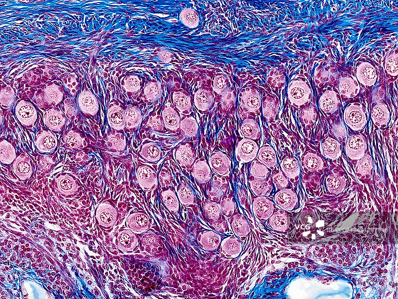 卵巢卵泡显微照片图片素材