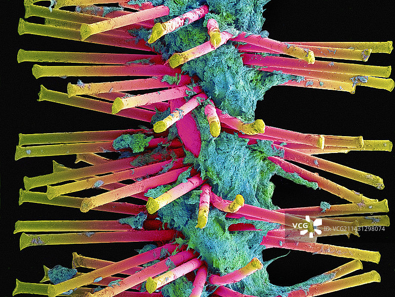 用过的齿间刷，扫描电镜图片素材