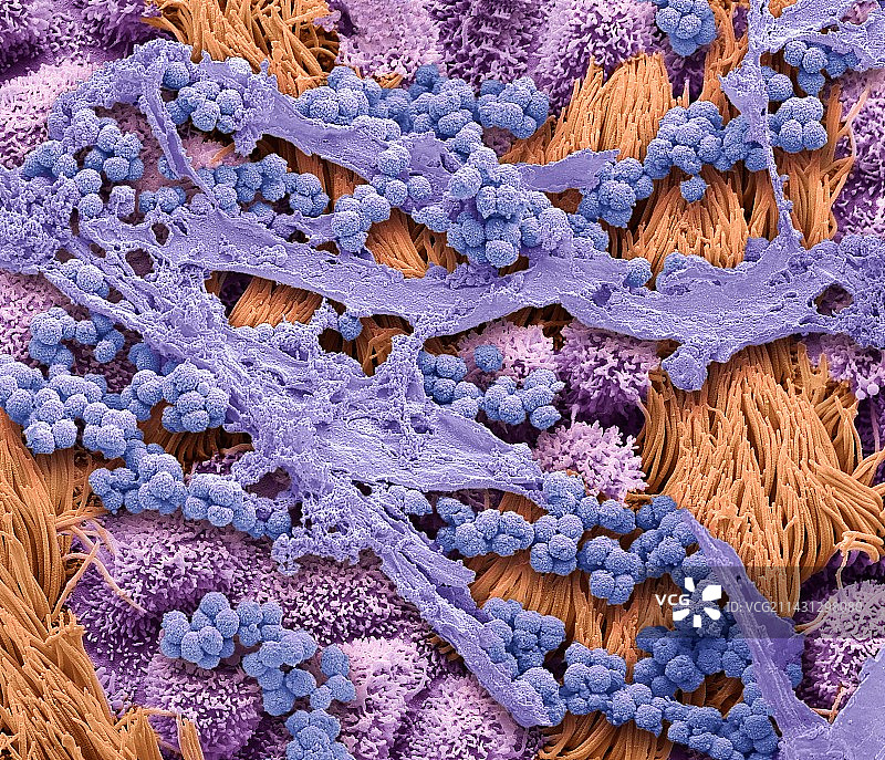 气道内的痰液，扫描电子显微镜图像图片素材
