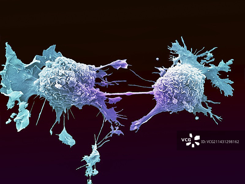 肺癌细胞分裂扫描电镜图图片素材