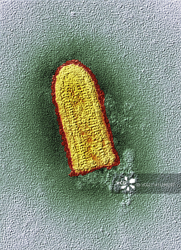 狂犬病病毒，TEM图片素材